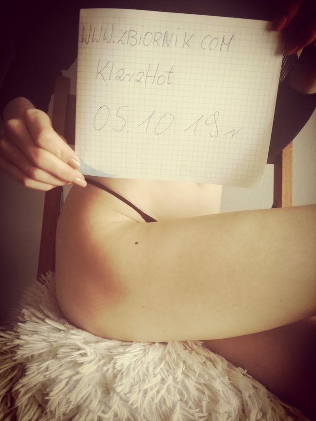 KlaraHot