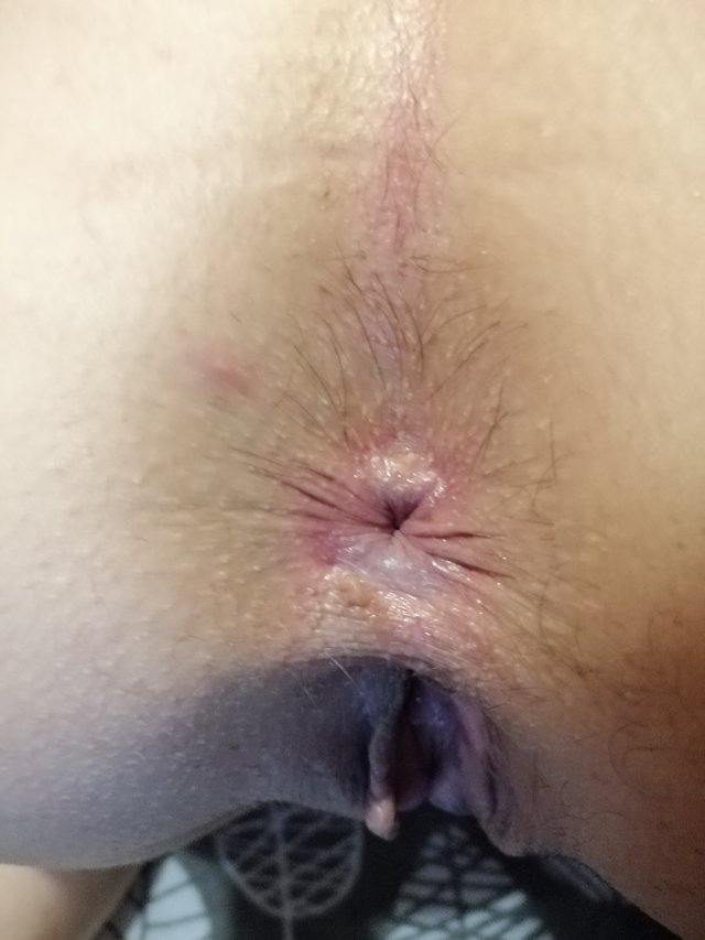 xxxZAKOCHANIxxx