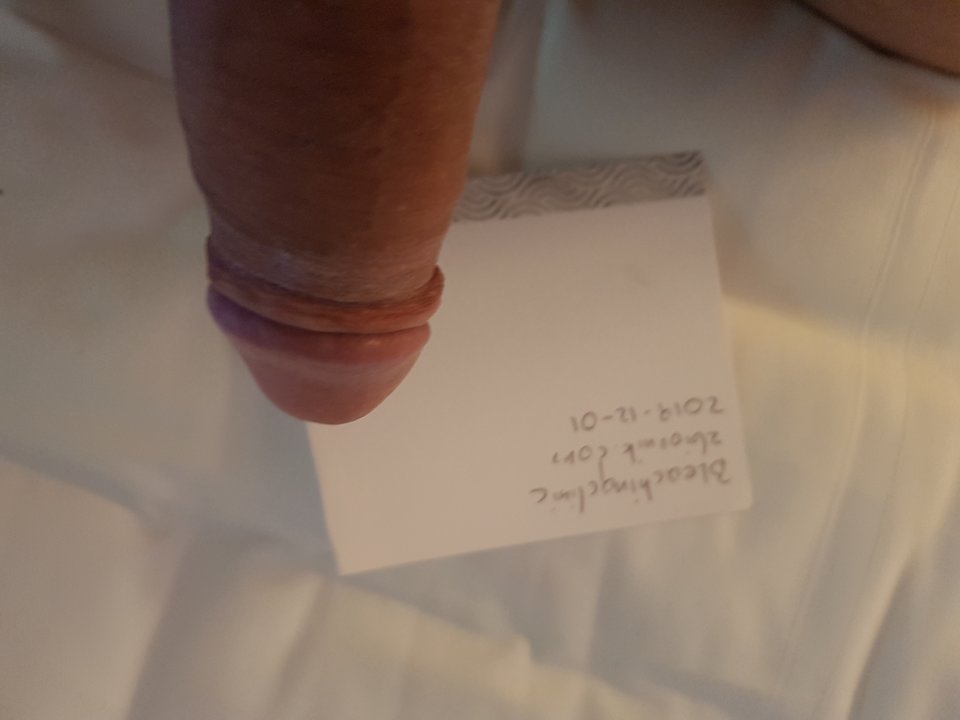 20191201_233030.jpg - Bleachingclinic