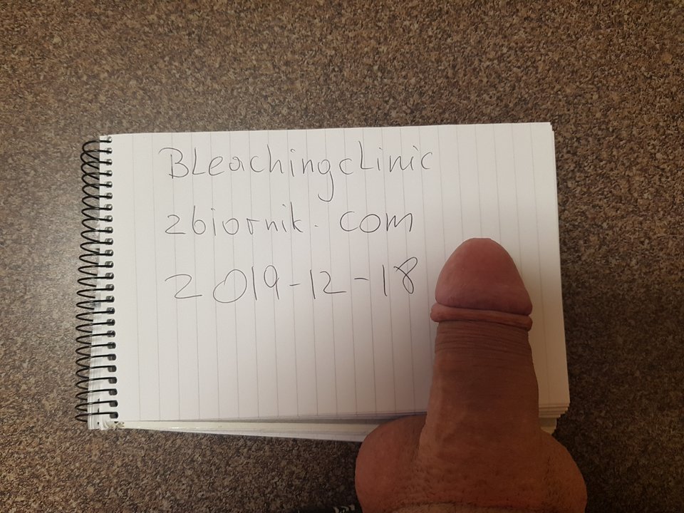 20191218_201012.jpg - Bleachingclinic
