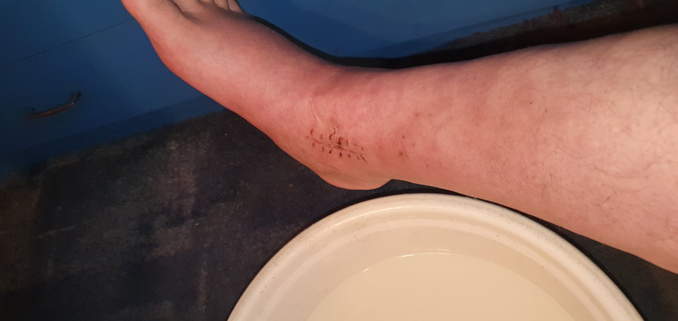 20191117_180040.jpg - zack34
