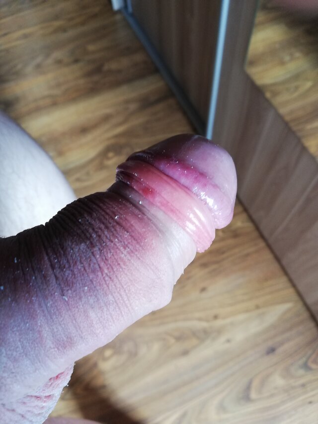makx9