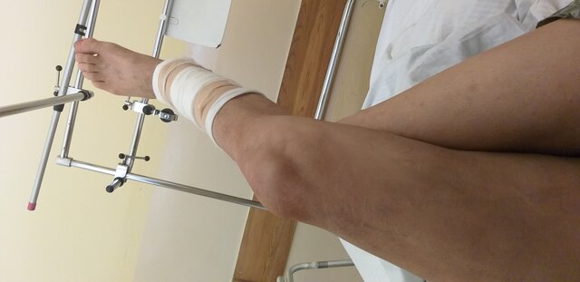 Pas16