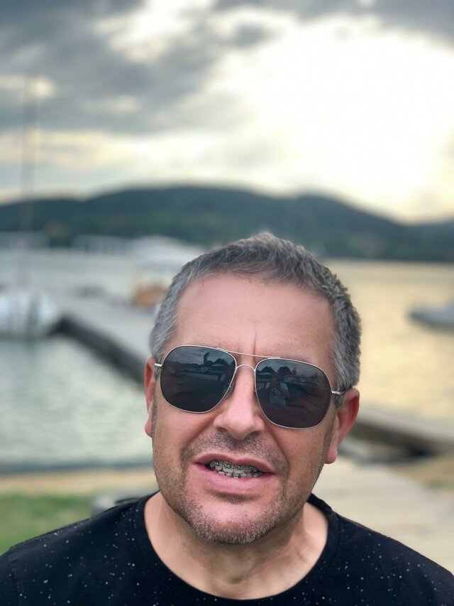 Blackhairy
