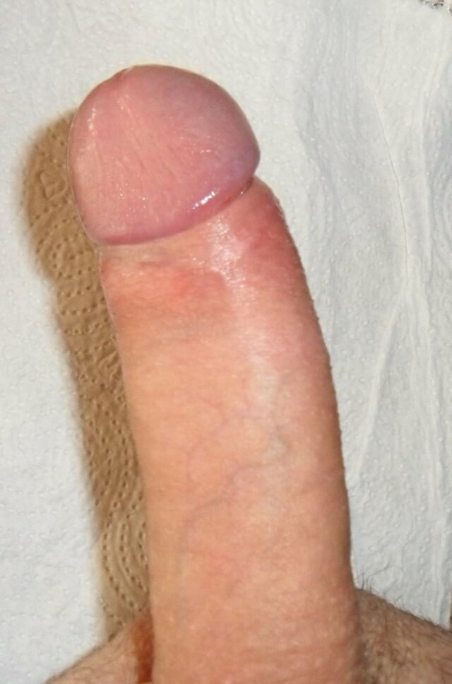 nostive