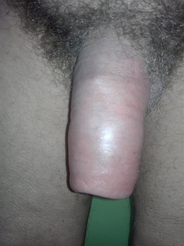 pupek60