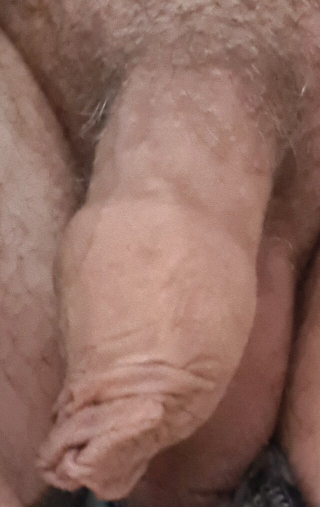 30lol