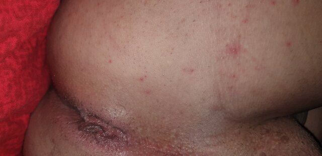 mis123513