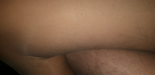 transnocka