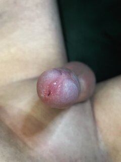1.