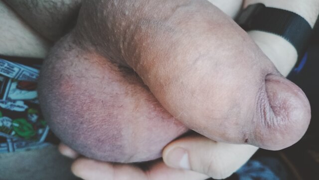 RATCVAC