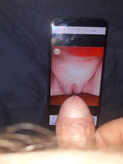 Od exalto1