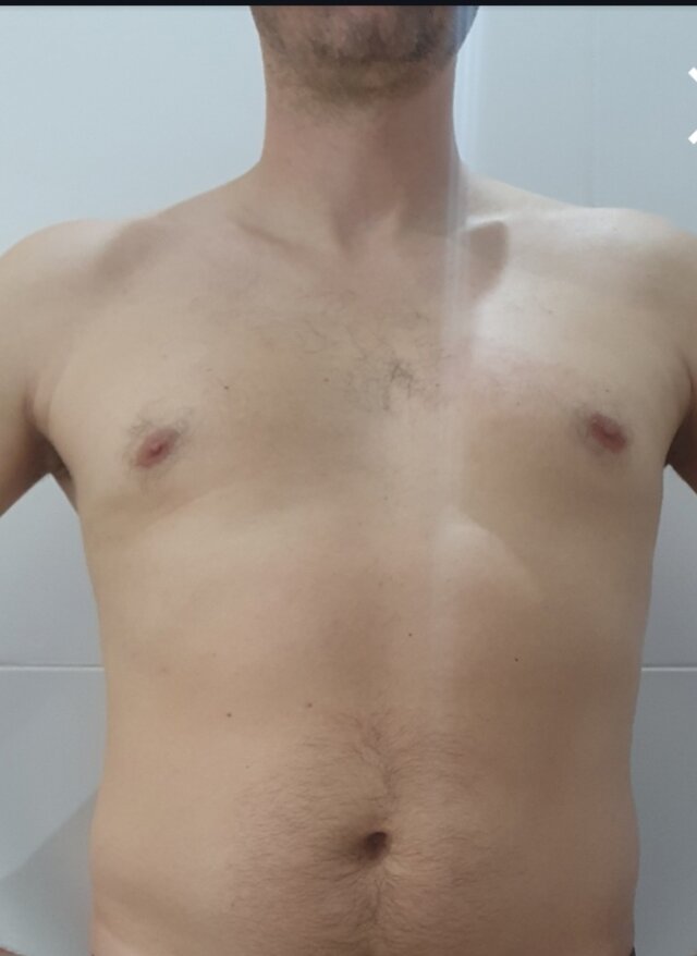 Mel7582