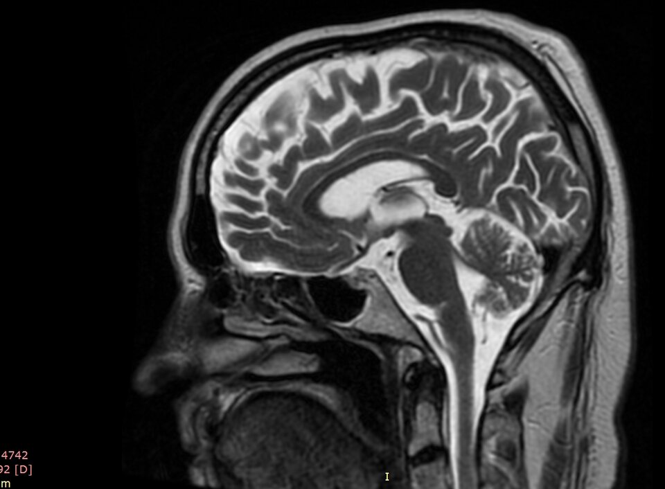 co mam w środku.jpg - bezpruderyjny50