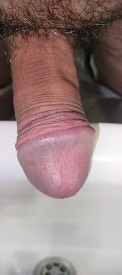 1000017793.jpg