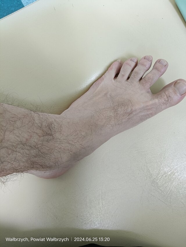 Ondoona