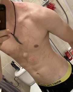 Bite for a bite?