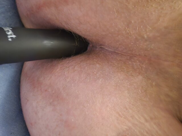 DBlack