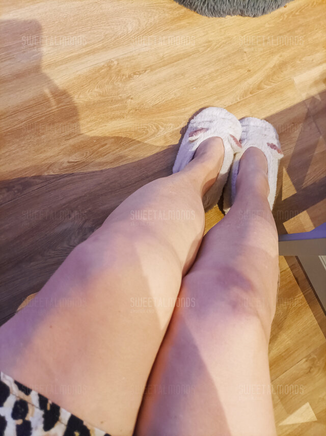 SweetAlmonds