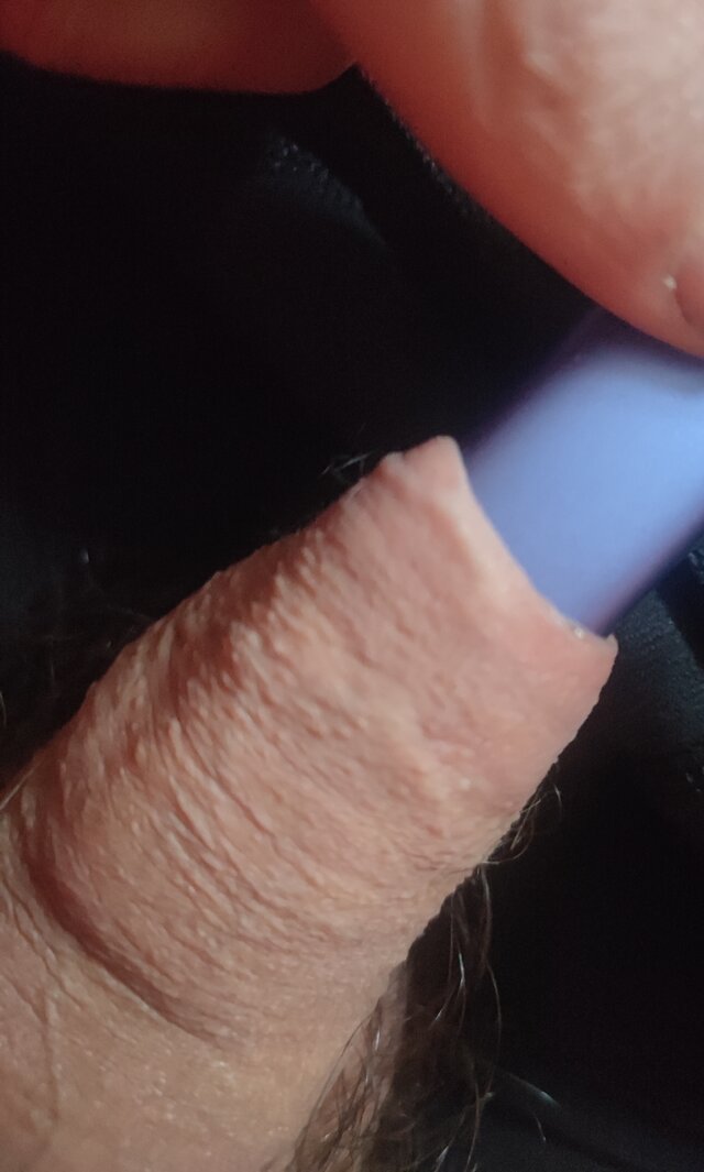 LUNIA_RUDA