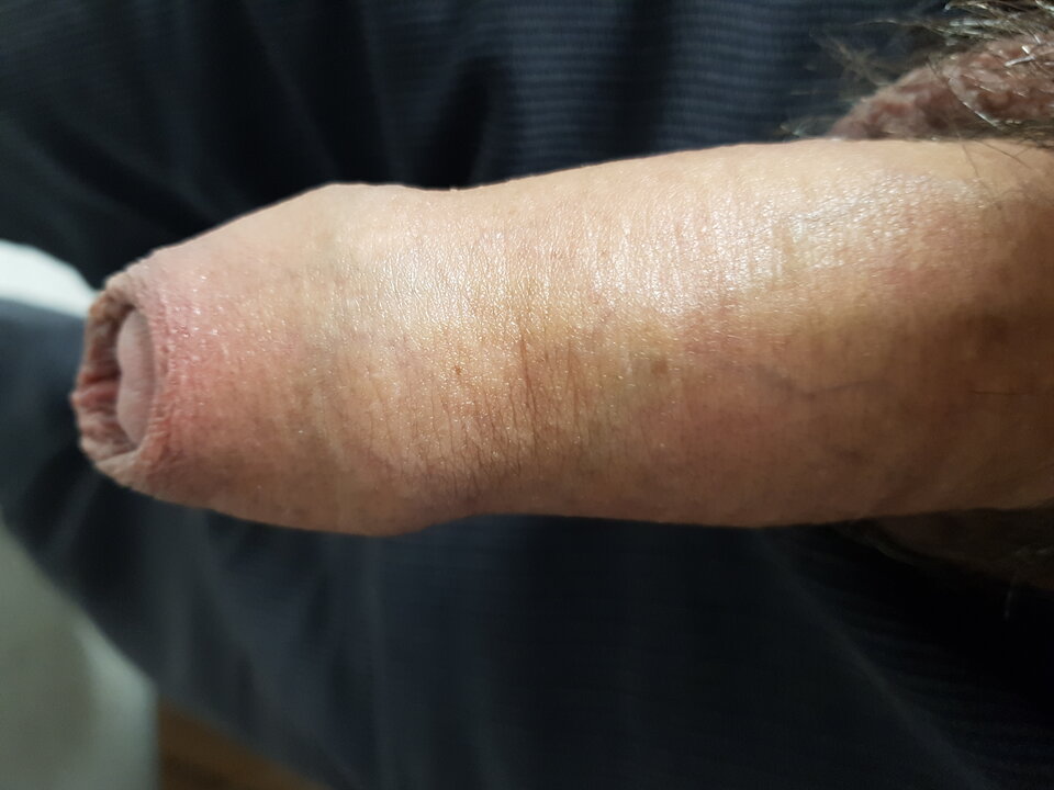 20250212_204458.jpg - Whitelittlecock