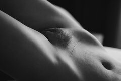 Scar