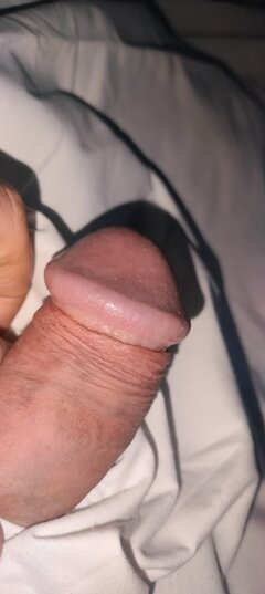 1000032291.jpg