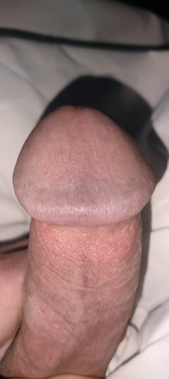 1000032293.jpg