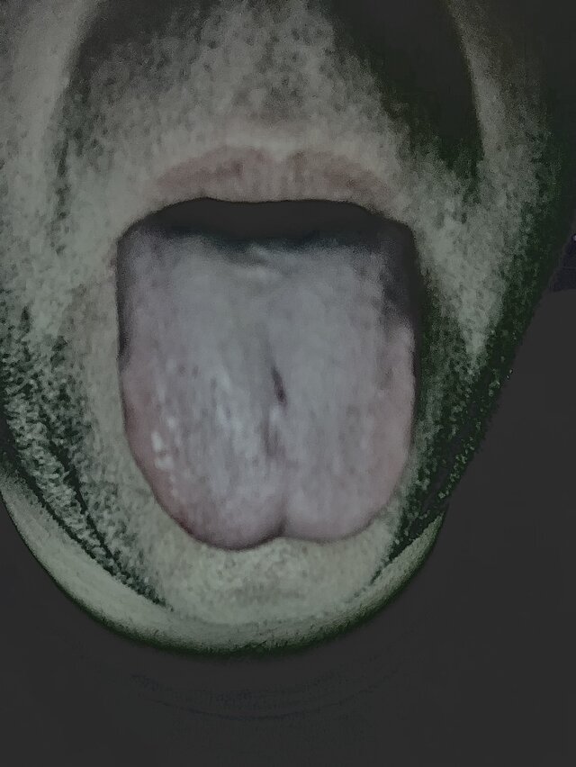 Towarzyskoon