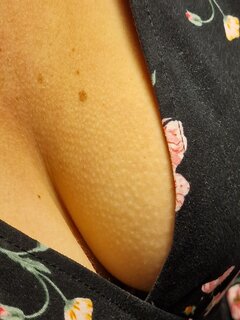 1000020032.jpg