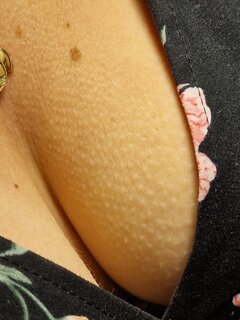 1000020031.jpg