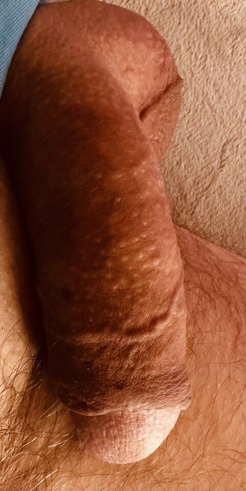 IMG_7734.jpeg - buzzzzz
