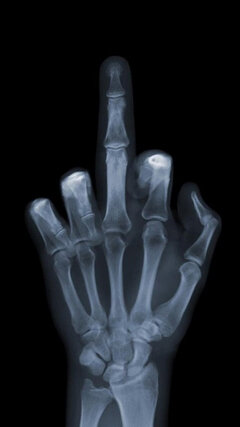 x_ray-wallpaper-10230196(1)_094213.jpg
