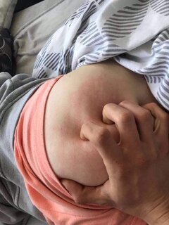 bez odbitej ręki na dupie się nie obejdzie 😁😈