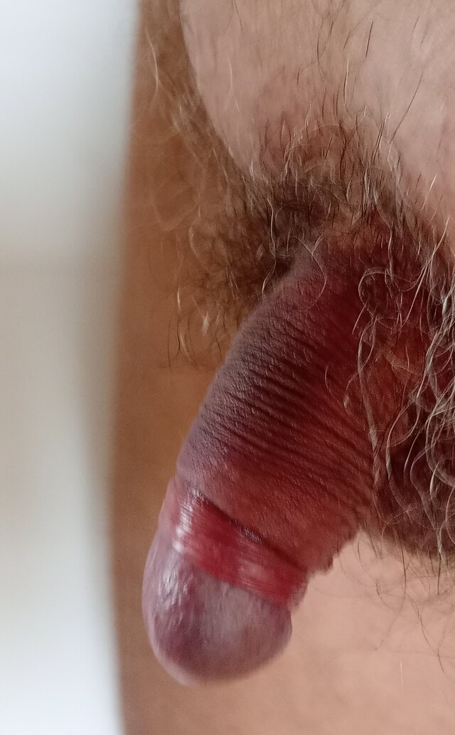 gil1