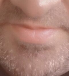 Lips