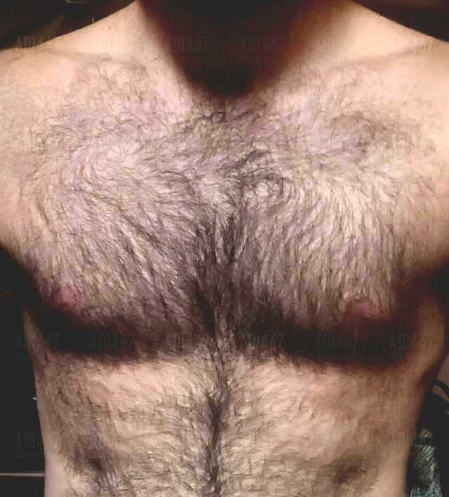 Adi467