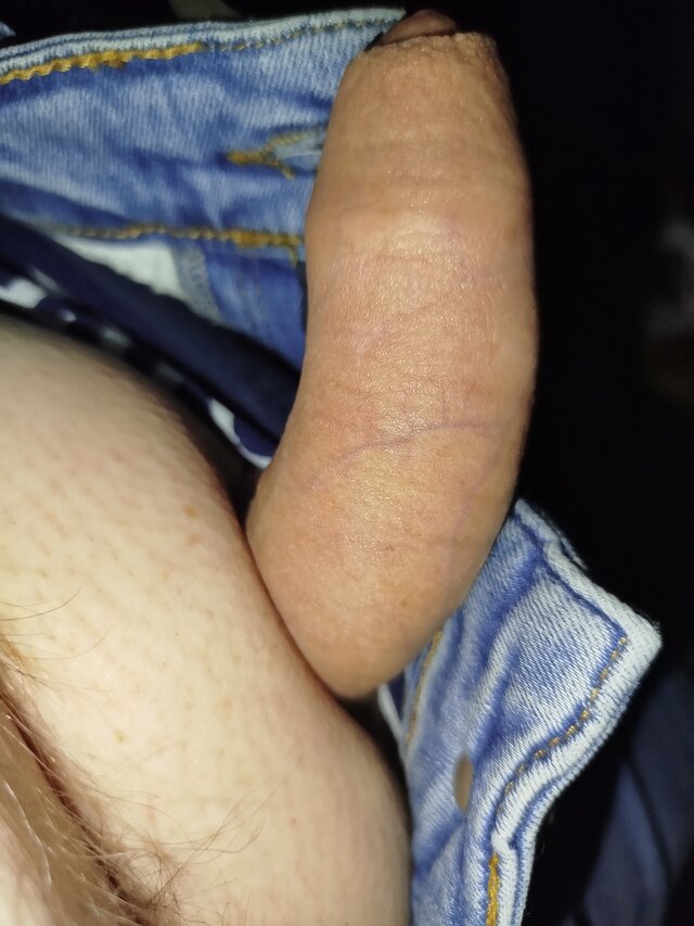 On37778