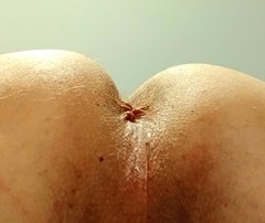 1000034533.jpg