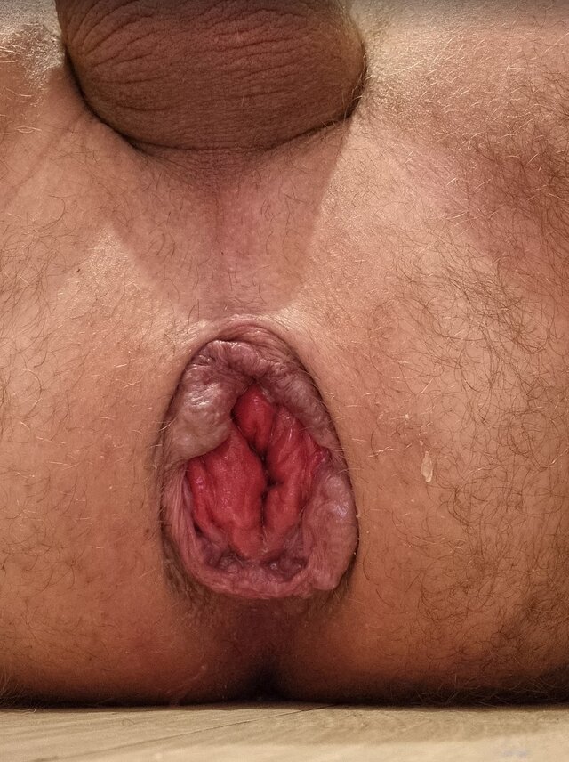 fistman