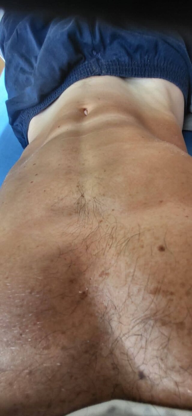 Erotom3