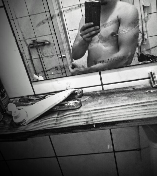 Brzoza11124444