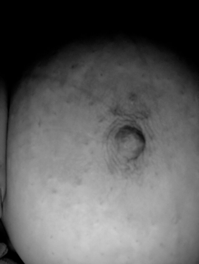 Xxxx09