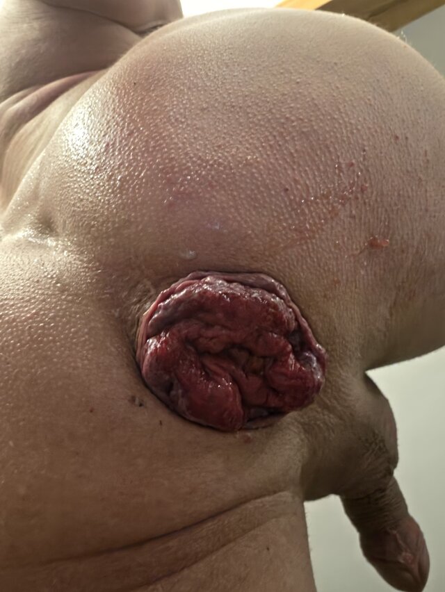 Magic_Holes