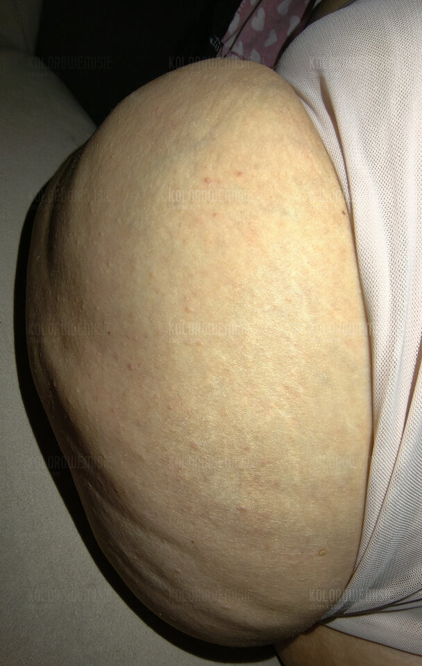 1000032298.jpg - kolorowemisie