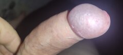 1000005915.jpg