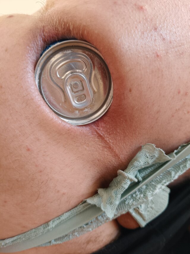 analhole