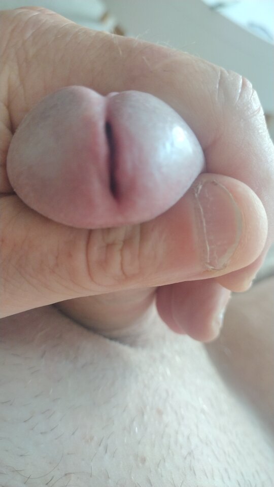 1786116097410530000962269946489.jpg - twoeyes