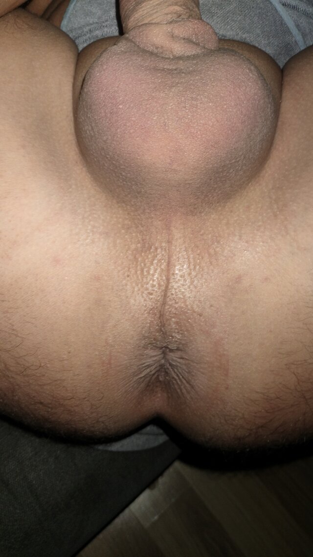 Pooss