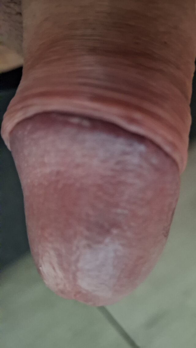 mar_nn40